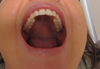 teeth line up