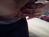 .  I’m guessing she laid me straight down instead of 90 degrees angle when she pulled/remove my hanging skin during the surgery.  She remove a total of 3lbs from my stomach and 1lb from each arm.  I personally thinks it should of been more specially after losing all this weight.  I stop using girdles a long time ago because that was folding my skin even more.  Now, when I’m at work or sitting on my couch I have to stick my hand through my clothes and press it between my rib cage for a few minutes to alleviate the pain because it does hurt and it’s uncomfortable.  My arm lift is also a problem, I don’t see much of a difference.