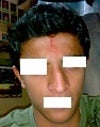 this is how it looks from front view