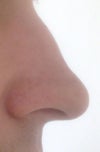 do you think a opn or closed approch hump removal + deproject tip