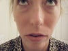 note: under eye lids