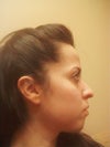 Profile 1