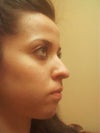 Profile 2