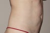 Dimple below belly button