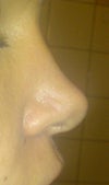 from side