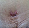 Close up