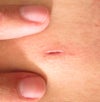 I am not pulling apart the skin. This is what it looks like for scale. Left side.