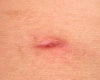 mu right side hole