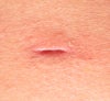 left side hole