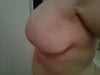 Side view -- side boob