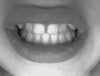 This is my gap