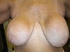 Breasts