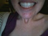 i'm afraid extracting teeth will make my smile very narrow and destroy my profile