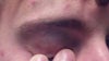 my eye, you cant really see the upper eye-brow one its real light at the moment.