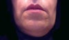 Front view with head tilted down.