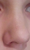 Oblique