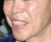 less cheekbones-more sagging now as cheeks not as full