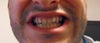 teeth