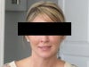 (Smiling) One week prior to Ultherapy procedure