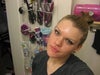 Month before surgery.
