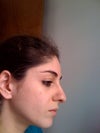 Before profile