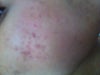 this the first side of my face