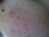 the second side of my face