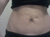 My stomach