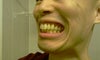 Vertically speaking teeth are mostly straight. Prob is tooth protrusion