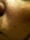 Rough, dry, skin texture