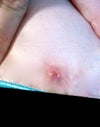 the white on the side is part of the stitch i cut it down since it was almost 1/2 inch long when i pulled it a little.