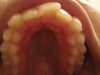 top teeth