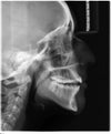 jaw xray