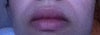 black shadows around my mouth