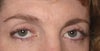 See the point on my right eye?