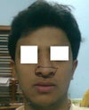 this is how my nose looks like