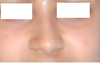 this is how i desire my nose to be...