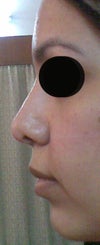 this pic taken after 3 or 4 hours from tape removal