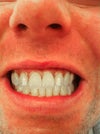 A smile design. Could I achieve a better result?