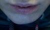 chin 5 wks post...you can feel its not centred.