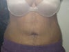 Not too obvious from front view, unless I am wearing a fitted top/dress