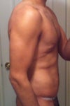Side View