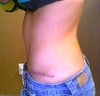 Flat from belly button and below with protrusion from about an inch above belly button to breast bone.
