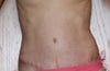 4 weeks after (approximately)