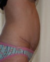 6 months after