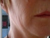 lip and cheek that needs treatment