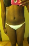 Frontside