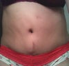Frontal