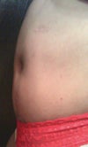 More side view.
