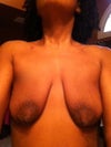Breast only